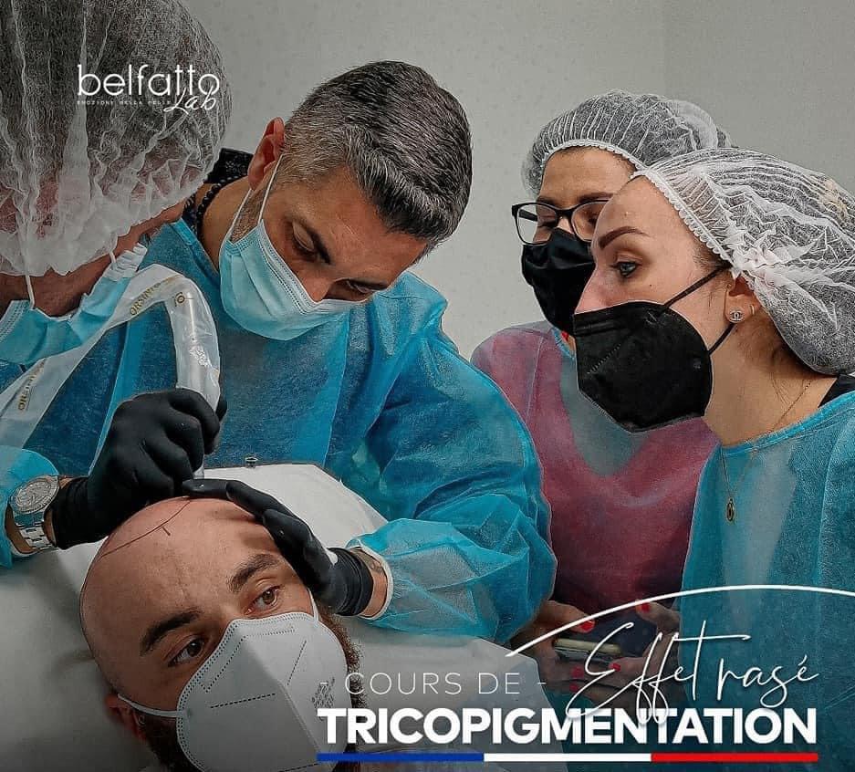 tricopigmentation @tonibelfatto effet crane rasé normandie  evreux paris havre alopecie calvitie perte de cheveux solution